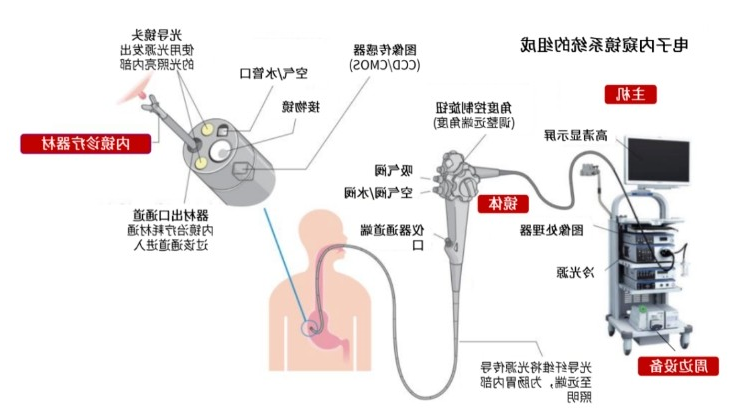 电子内窥镜系统的组成