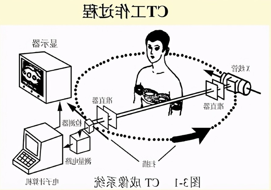 CT扫描仪成像原理