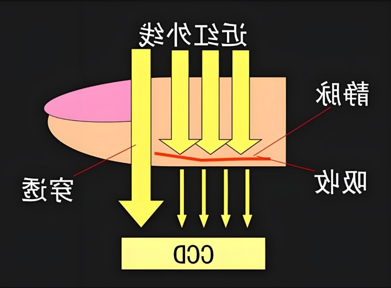 静脉显像仪原理