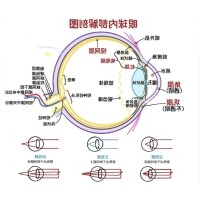 视网膜眼科中不同波长滤光片的应用